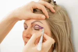 blefaroplastiche
