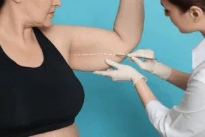 che cos'è la liposuzione che cos'è la liposuzione