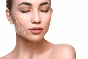lifting viso chirurgico
