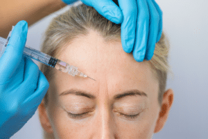Iniezioni di botox sulla fronte di una donna