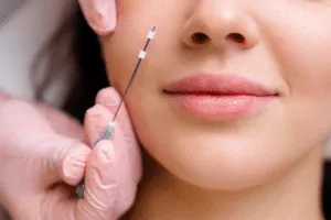 lifting viso chirurgico