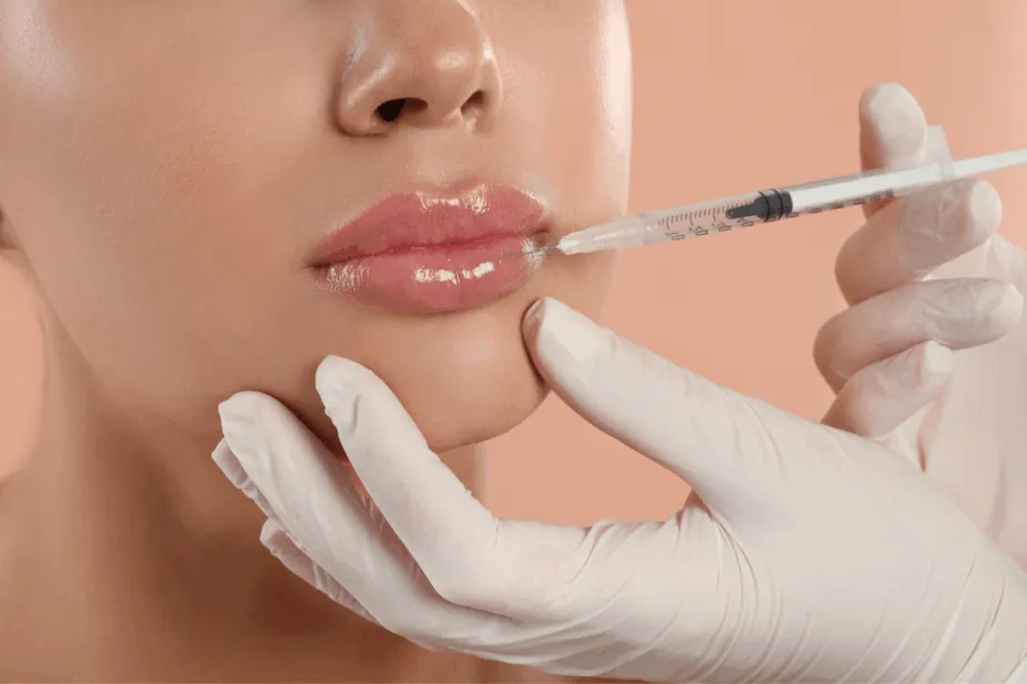 trattamento filler labbra