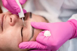 La blefaroplastica è considerata un intervento sicuro e affidabile